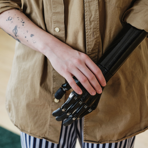 tipos de protesis de brazo